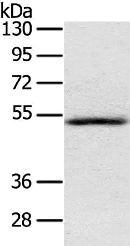 IHC-plus™ IL17RB Antibody