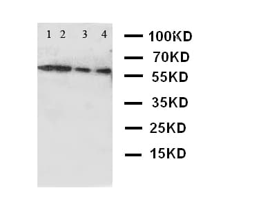 CAMKK2 Antibody (aa180-194)