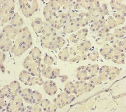 P2RX3 / P2X3 Antibody