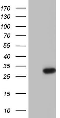 Monoclonal Mouse anti-Human PTCH1 / Patched 1 Antibody (clone OTI5G9, aa770-1027, WB)