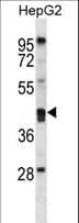 IHC-plus™ Polyclonal Rabbit anti-Human PON2 Antibody (aa79-107, IHC, WB)