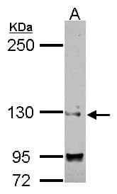 Polyclonal Rabbit anti-Human SAP130 Antibody (N-Terminus, IHC, WB)