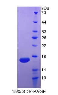 Human IL5 Protein (Recombinant His-T7)