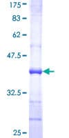 Human UGT1A6 Protein (Recombinant GST, N-terminus)
