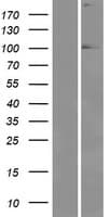 EYA1 Protein (Over-Expression Lysate Myc-DDK (Flag))