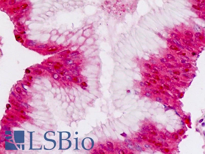 IHC-plus™ Polyclonal Rabbit anti-Human CDH3 / P-Cadherin Antibody (aa114-142, IHC, WB)