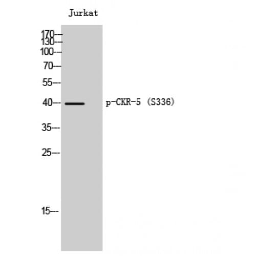 Polyclonal Rabbit anti-Human CCR5 Antibody (280-360 aa, WB)