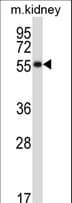 SSTR1 Antibody (aa351-380)