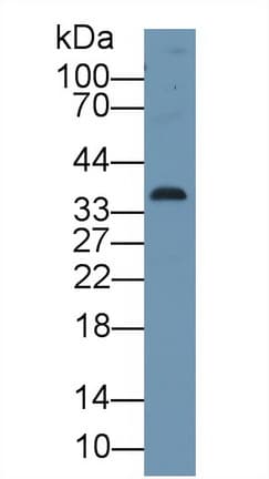 CDK1 / CDC2 Antibody (aa59-182)