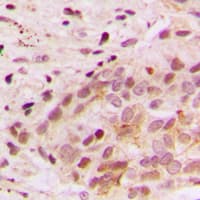 MAPK6 / ERK3 Antibody (Internal)