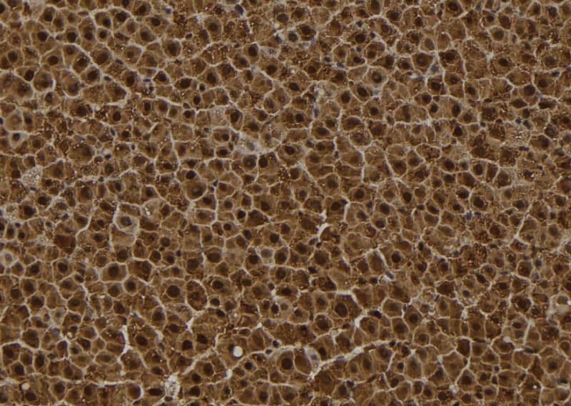 Polyclonal Rabbit anti-Human SESN2 / HI95 Antibody (aa335-359, IHC, WB)