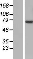 SLC25A13 / CITRIN Protein (Over-Expression Lysate Myc-DDK (Flag))