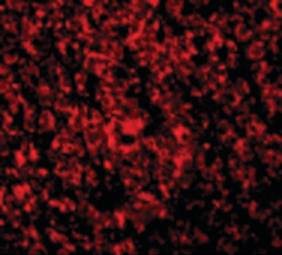 IHC-plus™ Polyclonal Rabbit anti-Human ARL6IP1 / ARMER Antibody (IHC, IF, WB)