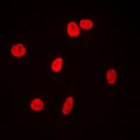 XRCC5 / Ku80 Antibody (C-Terminus)