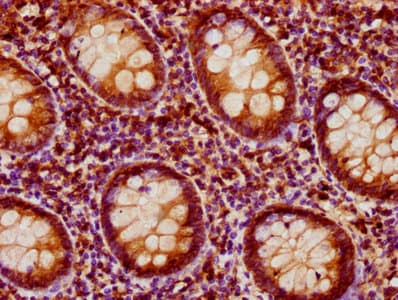 PEAK1 / SGK269 Antibody