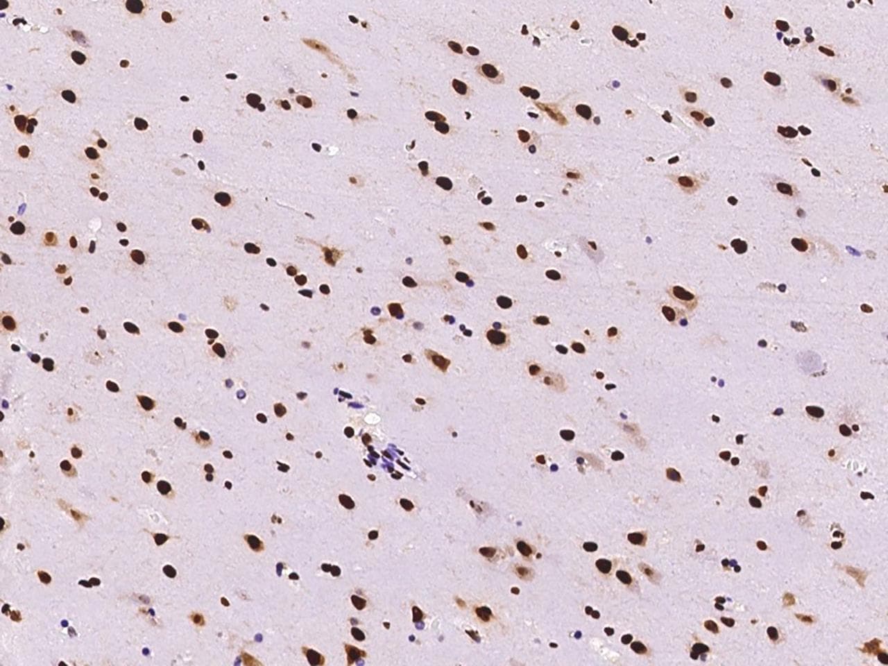Hypothetical Protein / TINP1 Antibody