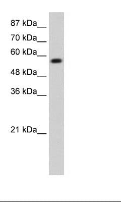 KEAP1 Antibody (aa21-70)