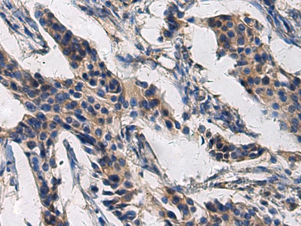 COL17A1 / Collagen XVII Antibody