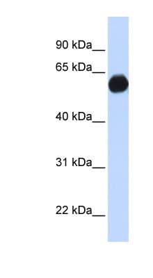 Polyclonal Rabbit anti-Human AKAP1 / AKAP Antibody (aa541-571, WB)