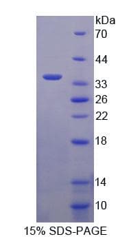 Human ASGR2 Protein (Recombinant His-T7)