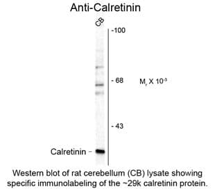 Polyclonal Sheep anti-Rat CALB2 / Calretinin Antibody (IHC, IF, WB)