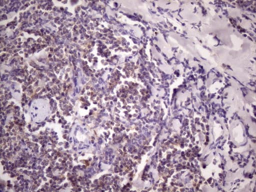 CD40 Antibody (aa21-166, clone OTI8G5)