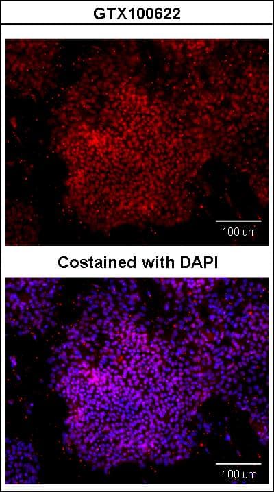 IHC-plus™ Polyclonal Rabbit anti-Human POU5F1 / OCT4 Antibody (IHC, IF, WB)