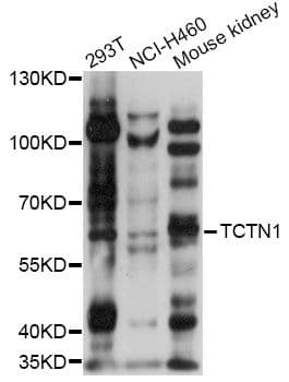 TCTN1 Antibody