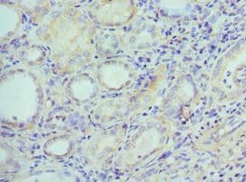 EFNB2 / Ephrin B2 Antibody (aa28-229)