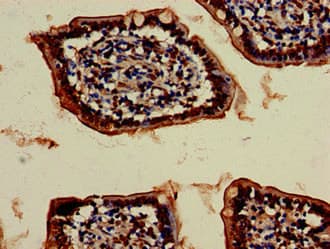 Polyclonal Rabbit anti-Human SKD1 / VPS4B Antibody (IHC, IF, WB)