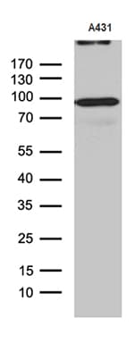 Monoclonal Mouse anti-Human MLH1 Antibody (clone OTI1B9, aa299-527, WB)