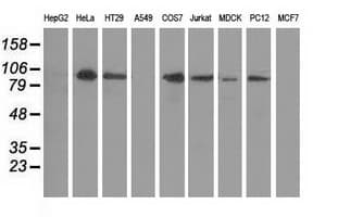 PRKD2 / PKD2 Antibody (clone OTI5G1)