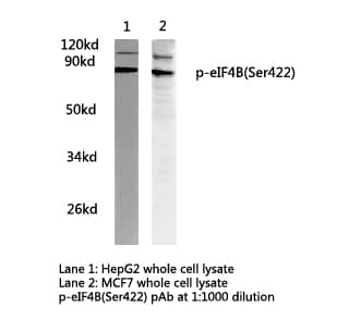 EIF4B Antibody (phospho-Ser422)