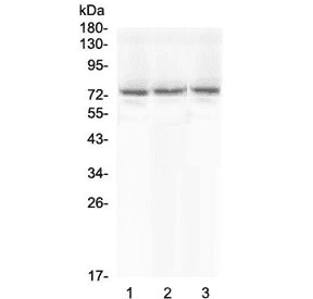 Polyclonal Rabbit anti-Human SCNN1A / ENaC Alpha Antibody (WB)