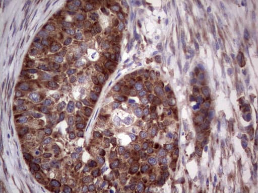 Monoclonal Mouse anti-Human LGALS3 / Galectin 3 Antibody (clone OTI2F1, Carrier-free, IHC, WB)