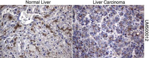 Monoclonal Mouse anti-Human SQSTM1 Antibody (clone UMAB12, Carrier-free, IHC, IF, WB)