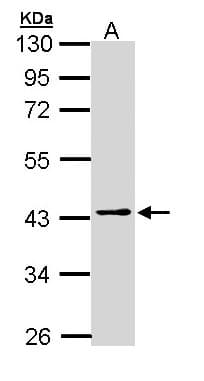 IHC-plus™ Polyclonal Rabbit anti-Human PSAT1 Antibody (aa48-328, IHC, WB)