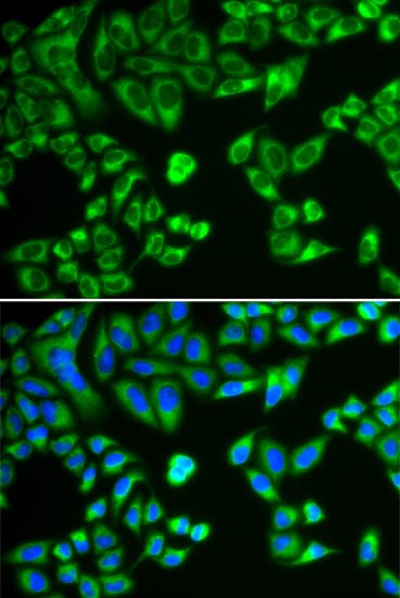 Polyclonal Rabbit anti-Human SH2B1 Antibody (IHC, IF, WB)