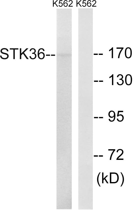 IHC-plus™ STK36 Antibody (aa387-436)