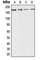 Polyclonal Rabbit anti-Human ACE / CD143 Antibody (Internal, IHC, WB)