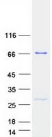 Human THUMPD3 Protein (Recombinant Myc-DDK (Flag))
