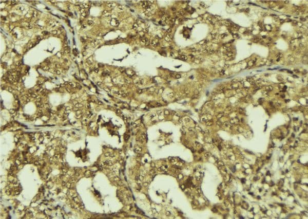FBXW7 / FBW7 Antibody