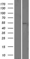 Human PSEN1 / Presenilin 1 Protein (Over-Expression Lysate Myc-DDK (Flag))