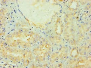 Polyclonal Rabbit anti-Human PRMT2 Antibody (aa1-300, IHC, WB)
