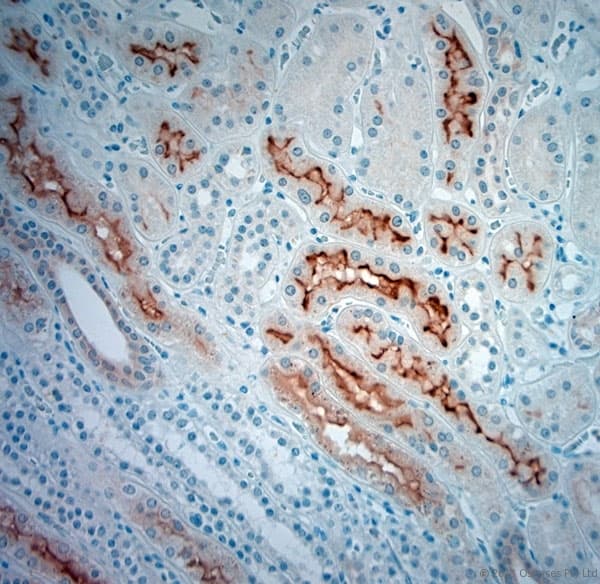 SLC5A8 / AIT Antibody (aa560-610)