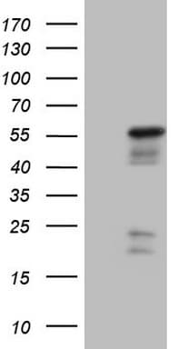 NR2E3 / PNR Antibody (clone OTI2F6)