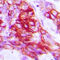 STX1A / Syntaxin 1A Antibody (N-Terminus)