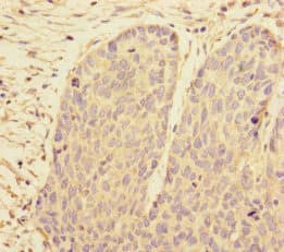 Polyclonal Rabbit anti-Human PRPF4 Antibody (IHC, WB)