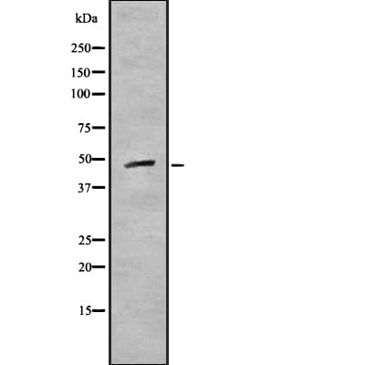 CSNK1G1 / CKI-Gamma 1 Antibody