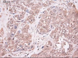 NTF3 / Neurotrophin 3 Antibody (clone OTI5C7)